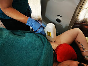 laser hair removal1.jpg